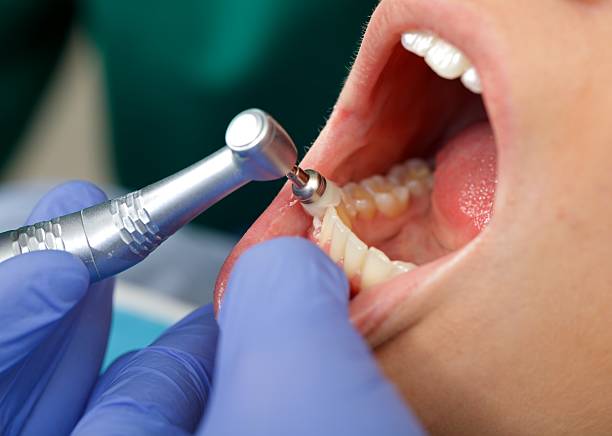 Oral Cancer Screening in Kaloko, HI